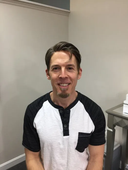 Hair restoration client, after, close detail